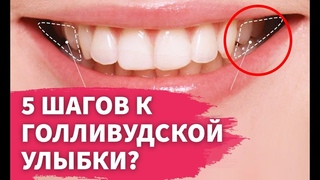 5 секретов голливудской улыбки