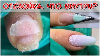 Отслойка гель-лака на ногте / Наращивание ногтей поэтапно / Наращивание ногтей для начинающих
