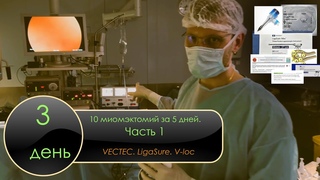 10 миомэктомий за 5 дней. 3 день. Часть 1. VECTEC. LigaSure. V-loc. Субмукозный узел.
