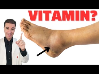 BR. 1 VITAMIN za UKLANJANJE OTEKLINA NOGU, NONIH ZGLOBOVA I STOPALA
