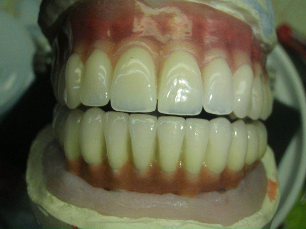 Эрнест Абрамян | Москва