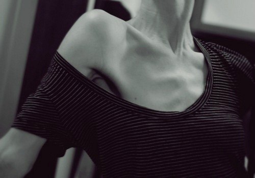 №9, Anorexia Nervosa, Boston №9, Anorexia Nervosa, Boston