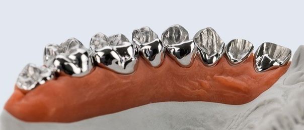 Сиенна миллер в молодости. Миллер зубы. Рецессия классификация миллера. Миллер зубы. Зуб с короной.