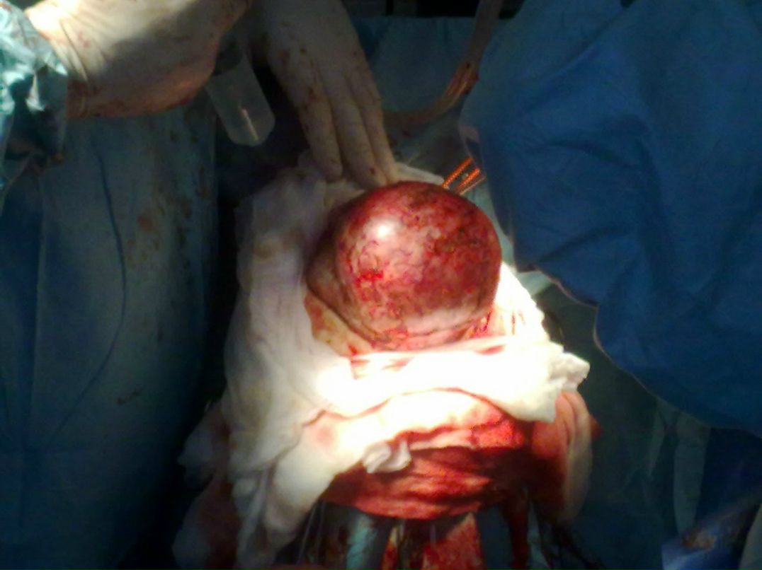 Эльгюн Мамедов | Москва