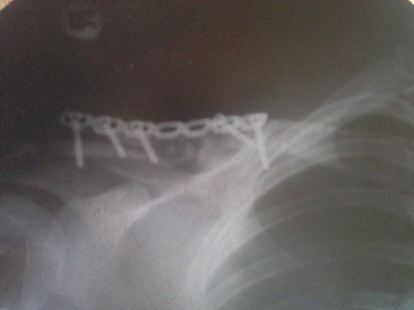 Стас Линник | Москва