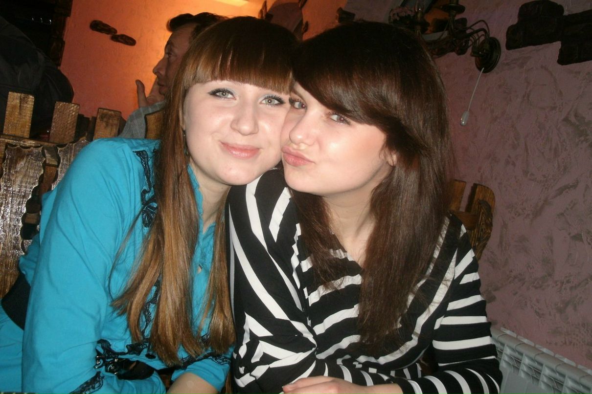 Анна Швец | Синяк