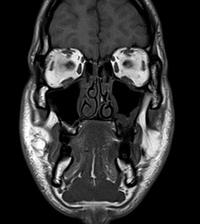 Кт томограмма головного мозга. Мрт головы и шеи. Череп на мрт. Компьютерная томография черепа. Магнитно-резонансная томография снимок головного мозга.