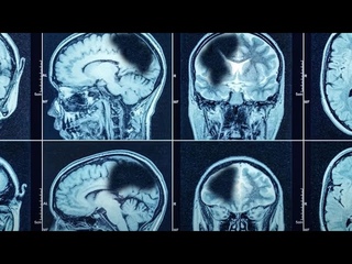 UFO Tears Apart Brains Of Witnesses