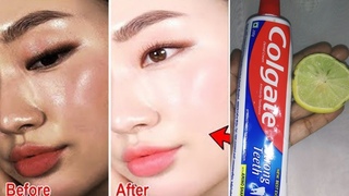 Colgate toothpaste for face whitening | Lemon and Colgate