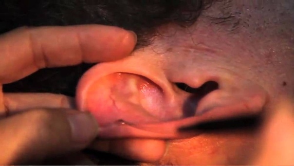Ear Picking in